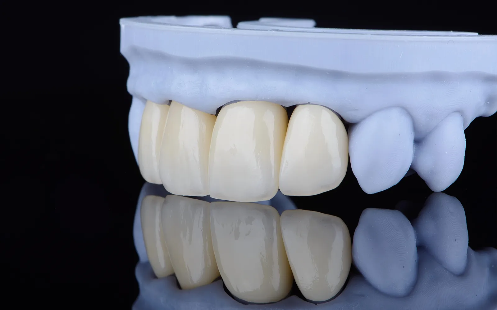 Ортопедичне відновлення зубів у Prosthodontic Center